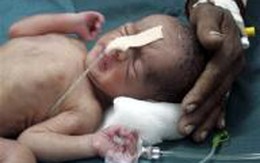 Bé gái sinh ra trong... WC rồi rơi xuống đường ray
